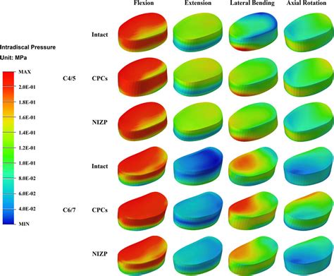 Frontiers Biomechanical Evaluation Of A Novel Individualized Zero