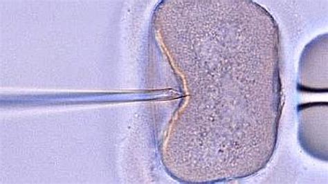 K Nstliche Befruchtung Kann Risiko Sein