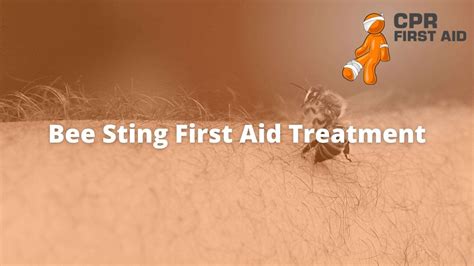 Bee Sting First Aid