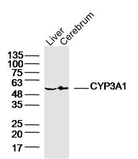 CYP3A1 Rabbit anti Human Polyclonal Bioss 100 μL Unconjugated