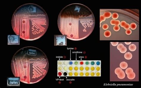 Bacterial Biochemical Identification Kits Creative Diagnostics