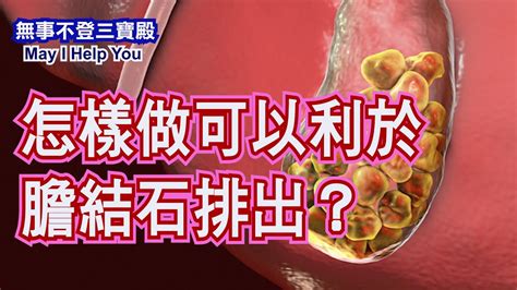 怎樣做可以利於膽結石排出？ Youtube