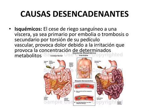 Pae Sindrome Doloroso Abdominal Ppt