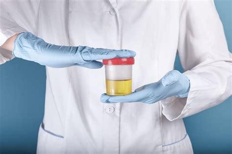 What Happens If I Refuse A Dot Drug Test Sap Referral Services