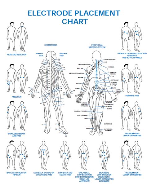 Tens Electrode Placement Chart Nimar Supply