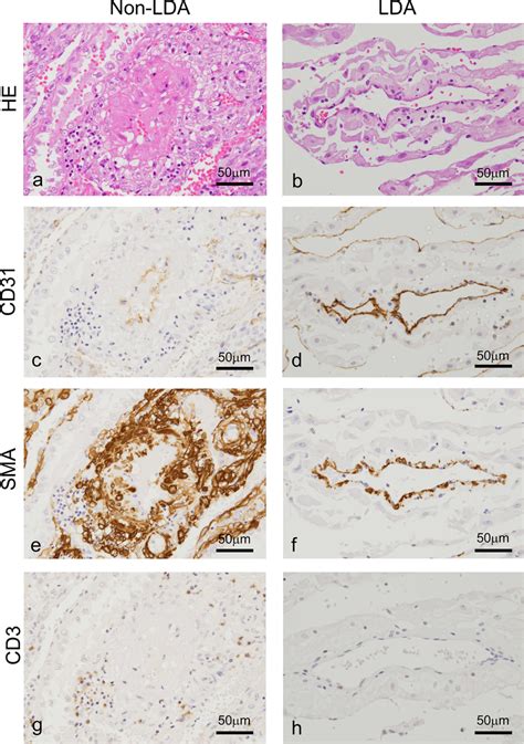 Histopathological specimens showing microscopic findings in decidual... | Download Scientific ...