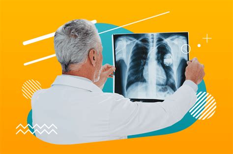 Este sigur să faci o radiografie pulmonară e medicina md