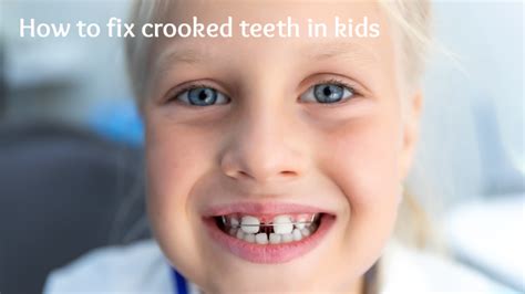 How To Fix Crooked Teeth Braceless Choice