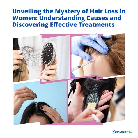 Unveiling the Mystery of Hair Loss in Women: Understanding Causes and ...