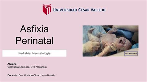 Asfixia Perinatal Alexandra Udocz