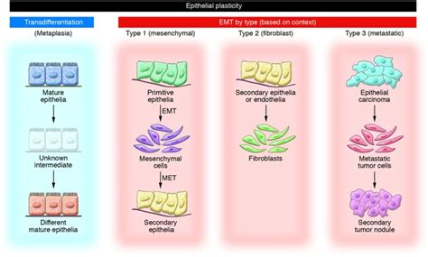 Jci Biomarkers For Epithelial Mesenchymal Transitions