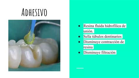 Adhesivos dentales tipos función y usos clínicos PPT