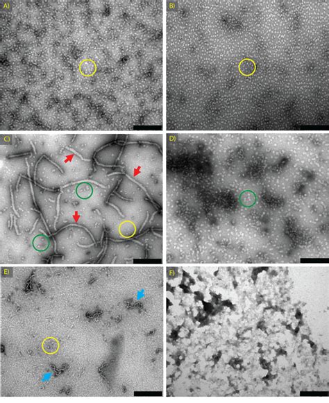 Transmission Electron Microscopy TEM Images Of Samples Formed To