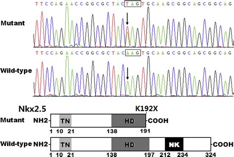 A Novel Nkx25 Loss Of Function Mutation Associated With Congenital