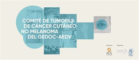 El GEDOC pone en marcha el Comité de tumores de cáncer cutáneo no