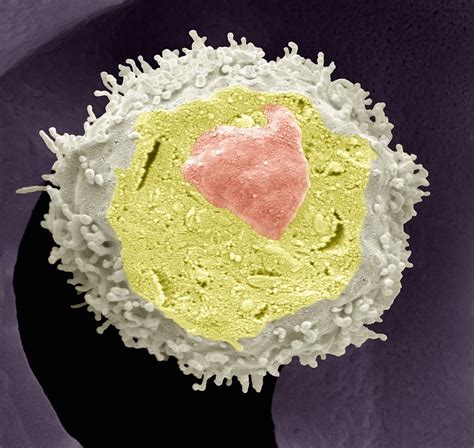 Lymphocyte White Blood Cell Sem Photograph By Steve Gschmeissner