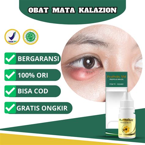 Jual Obat Oles Mata Kalazion Benjolan Di Kelopak Mata Kelopak Mata