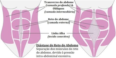 DIÁSTASE ABDOMINAL O que é o que causa e como tratar Elastique