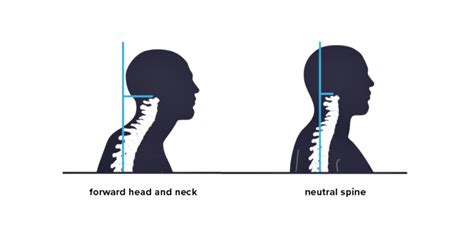 Stronger Backs For 2022 Perfect Posture Bansel Osteopath