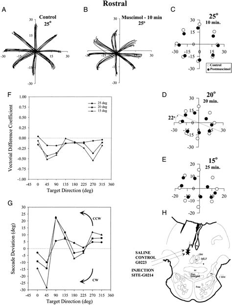 Hypometric Vertical Saccades Developed After A Muscimol Injection In