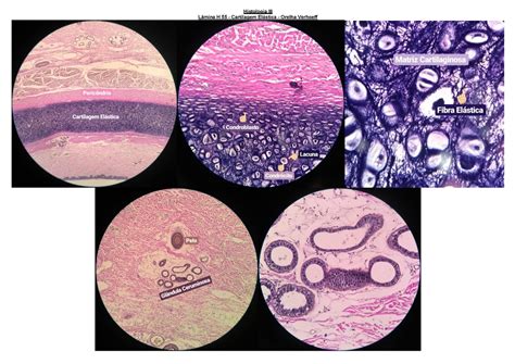 2º Ano Módulo 8 Roteiro 2 Histologia Orelha Histologia Iii