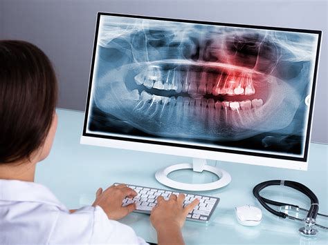 Sterling Smiles Azle How To Slow Down Bone Loss In Teeth