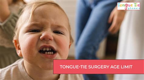 Tongue-Tie Surgery Age Limit: When is the Best Time?