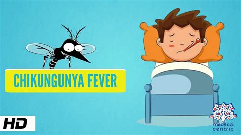 Chikungunya Fever Causes Signs And Symptomsdiagnosis And Treatment