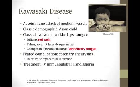 Vasculitis • Kang Rui Xiangs Notes