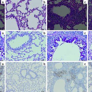 Histological Analysis Of Lung Sections Of Different Groups A The