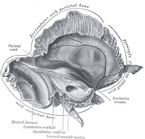 [figure The Left Temporal Bone Inner Surface] Statpearls Ncbi