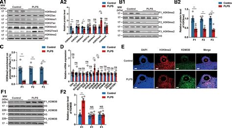 Prenatal Lipopolysaccharides Exposure Induces Transgenerational