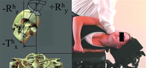 In A, Skeletal image representing patient's abnormal posture of a... | Download Scientific Diagram