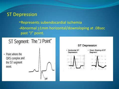 Ppt Evaluating Cardiovascular Diseases With Cardiac Spect And Pet