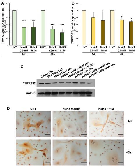 TMPRSS2 Expression In HNEpC Panels AC MRNA And Protein Expression