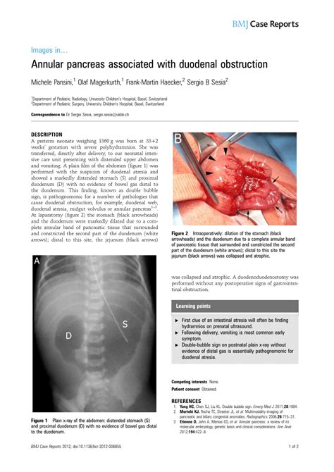 Pdf Annular Pancreas Associated With Duodenal Obstruction