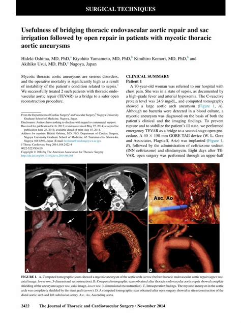 PDF Usefulness Of Bridging Thoracic Endovascular Aortic Repair And