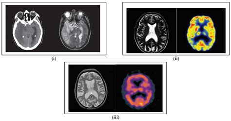 Electronics Free Full Text Artificial Intelligence Based Multimodal