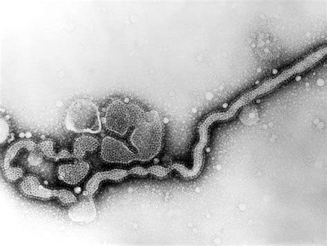 Free Picture Transmission Electron Micrograph Influenza Virus