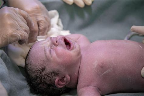 Recién nacido llorando después del parto Foto Premium