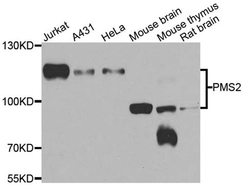 pms polyclonal antibody pa