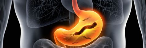 Qué es Helicobacter pylori Glosario Unilabs