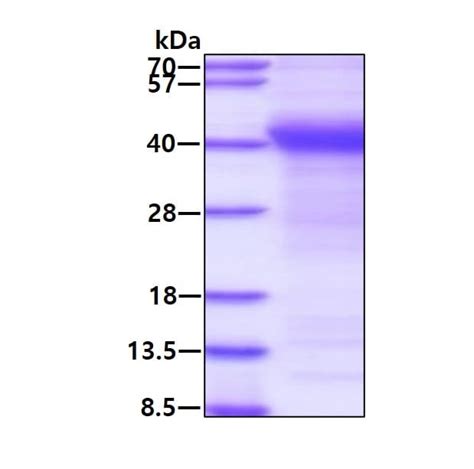 Recombinant Anti Amyloid Precursor Protein Antibody [y188] Ko Tested