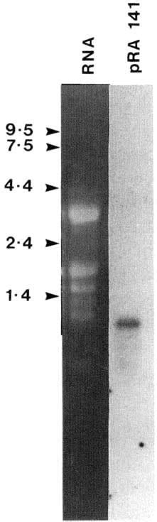 Composite Photograph Showing Ethidium Bromide Stained Agarose Gel Of R