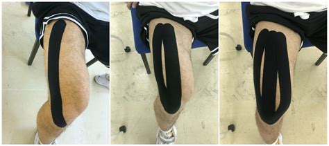 Frontiers Short Term Effects Of Kinesiology Taping On Static And