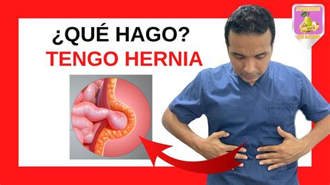 QUÉ SON LAS HERNIAS ABDOMINALES Dr Elmer Luna Vilchez y Dr Edwin