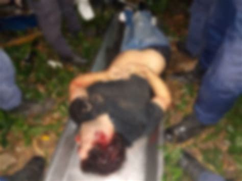 Falleció joven tras chocar contra un árbol en Maracay