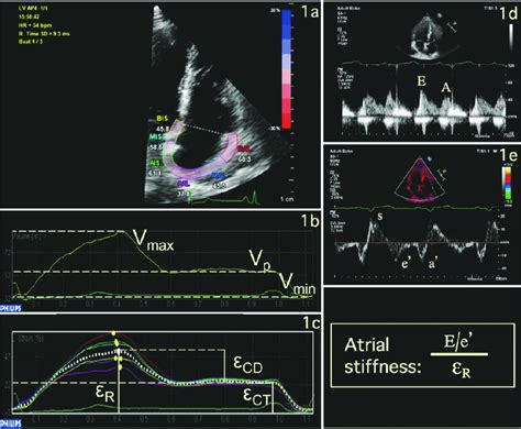 Rv Focused Apical 4 Chamber View Depicting The Region Of Interest 1a