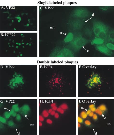 Indirect Immunofluorescence Of Hsv 1f Infected Cell Plaques Singly