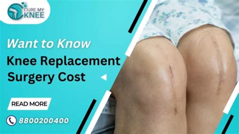 Total Knee Replacement Surgery Cost In Delhi Ncr India